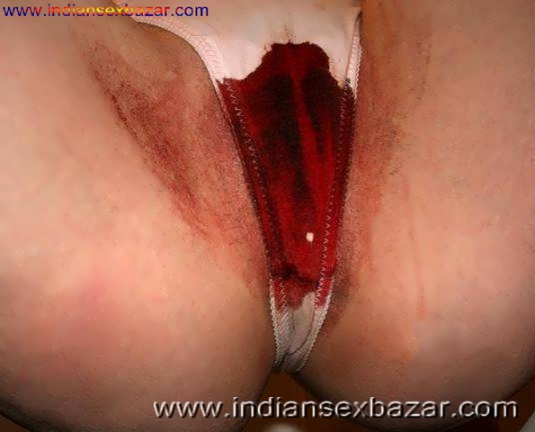Virgin sex pussy bleeding pictures gallery